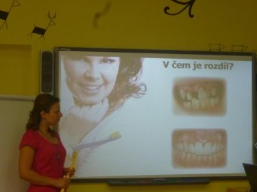 P�edn�ka studentek L�ka�sk� fakulty UHK - O dent�ln� hygien�